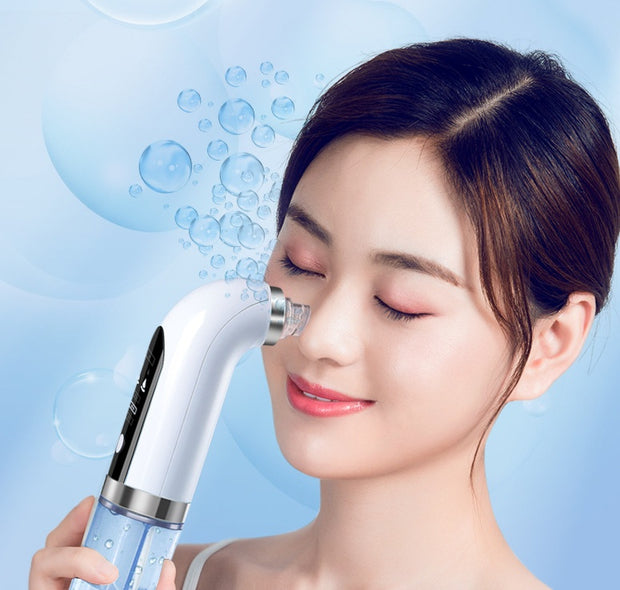 Angeluxe™ ClearLift – Rechargeable Blackhead Remover✨
